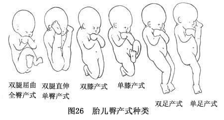 B超臀位还能顺产吗，会不会发生难产有危险？