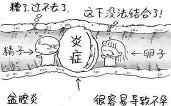 艾琳达治疗妇科,艾琳达旋磁仪价格