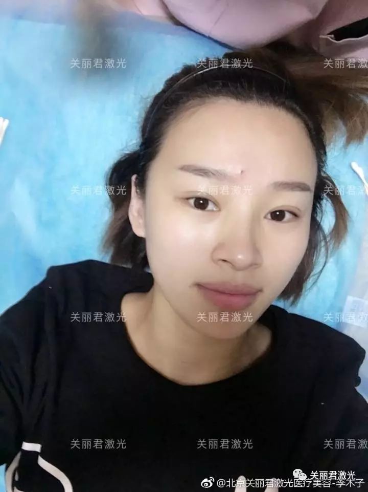 医学美白嫩肤方法,医生推荐的美白食疗方法