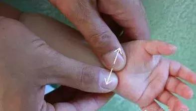 小孩发烧怎么做推拿退热,小儿退热法宝推拿附动图