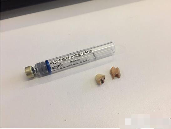 隔空给葛优拔牙：一直在红火，从未被超越！打假俱乐部：真幽默！