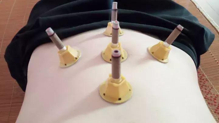 天冷手脚冰凉可以艾灸脚吗,天冷手脚冰凉可以艾灸涌泉穴吗