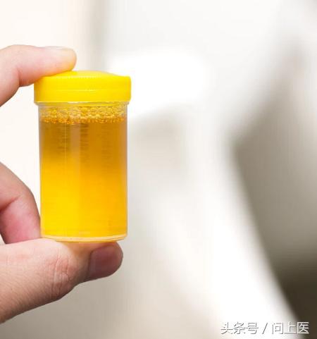 黑色素瘤的癌症早期有哪些症状,9种癌症早期症状早发现早识别