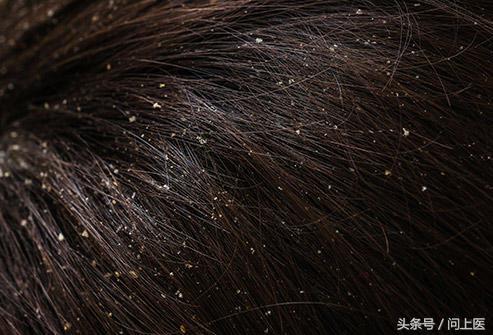 醋能降血压血糖吗,醋有降压降糖作用吗