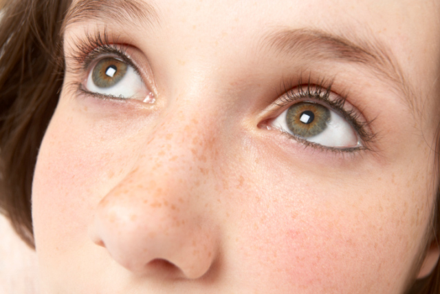 孕期妈妈皮肤变黑,孕晚期长褐斑