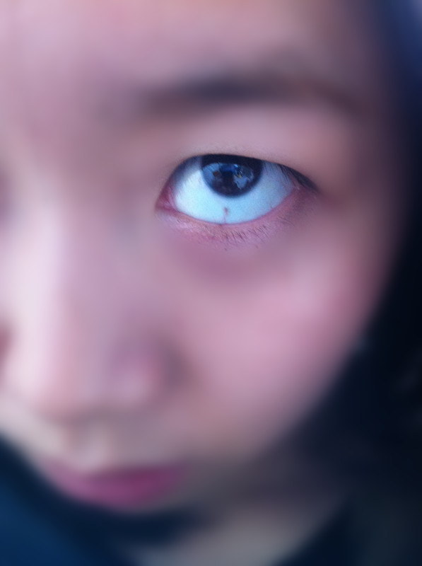 眼球凸出眼睛是变大还是变小,眼球正常是凸出来多少