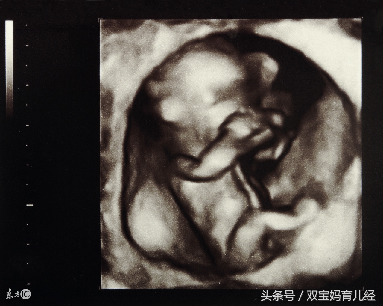 肚子里的宝宝把妈妈踹哭了,肚子里的宝宝半夜重重的踢了两脚