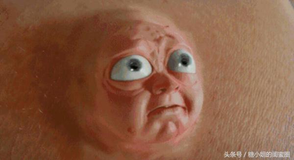 痘痘闭口2020,长痘痘闭口的原因和改善方法