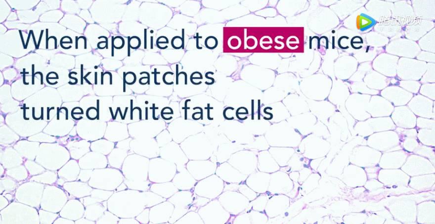 不用节食一周也能瘦8斤的方法,15天减掉20斤脂肪的方法