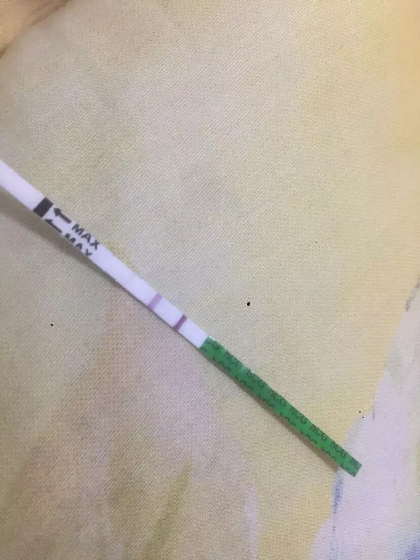 多囊卵巢一旦怀孕就自愈了吗,多囊卵巢一直不治疗会怎样