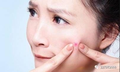 痘痘形成的内在原因和外在原因,痘痘形成的八大原因