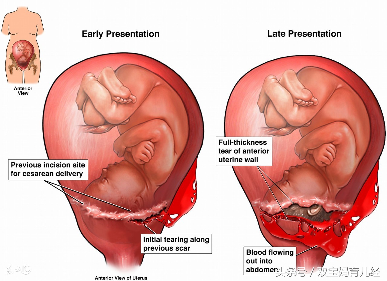 肚子里的宝宝把妈妈踹哭了,肚子里的宝宝半夜重重的踢了两脚