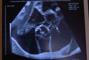 孕妈妈胎动问题集锦，你是哪一种？快来对号入座最详细的说明