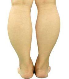 小腿肚子粗怎样通过锻炼改善,小腿粗怎么改善最好视频