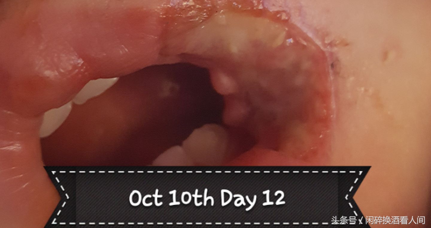 儿童接触手机充电器事故,儿童充电器事故视频