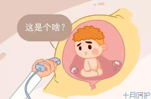 江门月子中心｜孕期腹痛不可轻视，谨慎是胎盘出了问题！