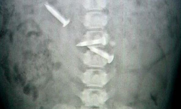 狗狗和主人玩闹时突然躺下露肚子,狗狗被主人肚腩吓到了