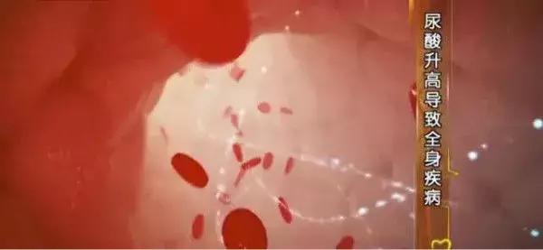 又一吃出来的大病！“三高”之外的“第四高”，让1.7亿人深受困