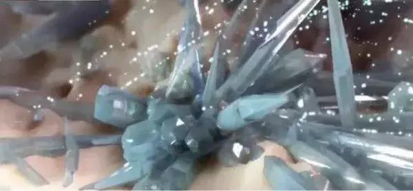 又一吃出来的大病！“三高”之外的“第四高”，让1.7亿人深受困