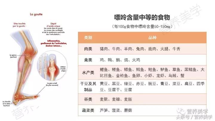 高尿酸血症饮食指南,高尿酸血症的饮食一览表