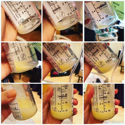 胡杏儿剖宫产,胡杏儿剖腹产还是顺产