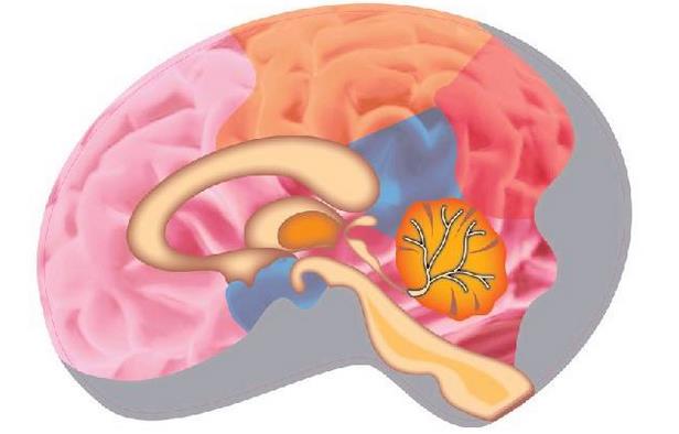 立体定向放射治疗让脑瘤患者生存,放射性粒子植入治疗脑瘤