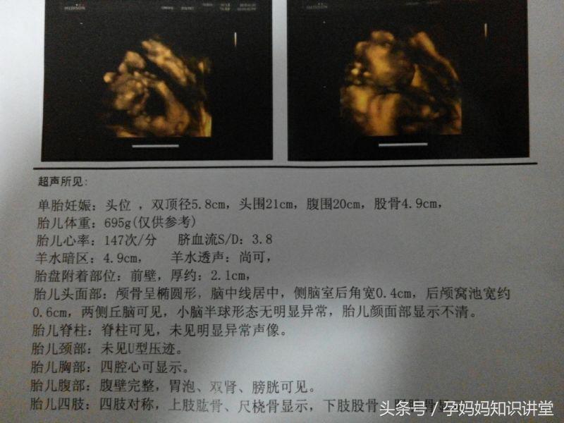 拍四维彩超让关注左肾情况,做四维彩超需要关注什么