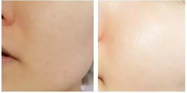 敷面膜之前怎么保养,换季时敏感肌肤可以用的保湿面膜