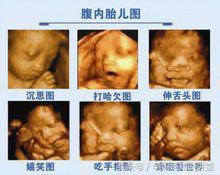 拍四维彩超让关注左肾情况,做四维彩超需要关注什么