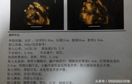 拍四维彩超让关注左肾情况,做四维彩超需要关注什么