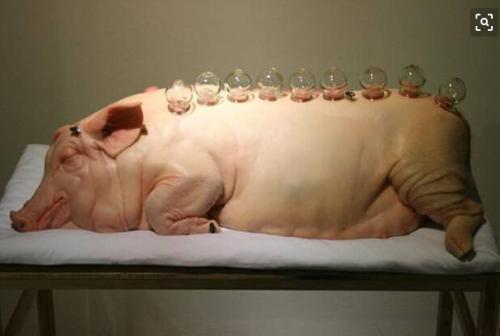 拔罐，是养生还是自虐？｜话题吧