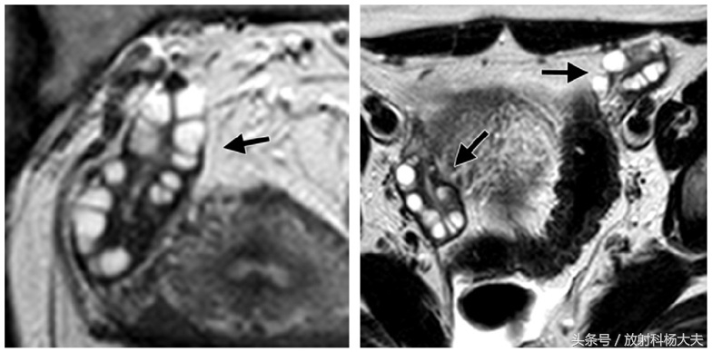 女性不孕与体内抗体有关吗,不孕症各个因素分布图