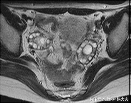 女性不孕与体内抗体有关吗,不孕症各个因素分布图