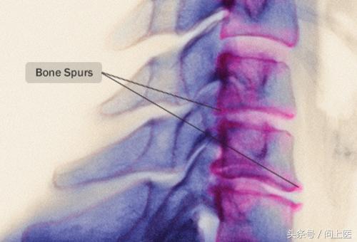 颈部疾病怎么护理,颈部疾病病人的护理
