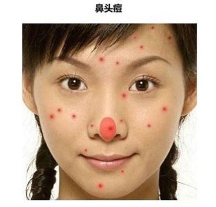 「看图识别长痘原因」还在苦恼长痘，如何祛痘，点开此文绝不后悔