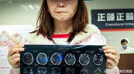 韩国人整形价格表,韩国割双眼皮要多少钱