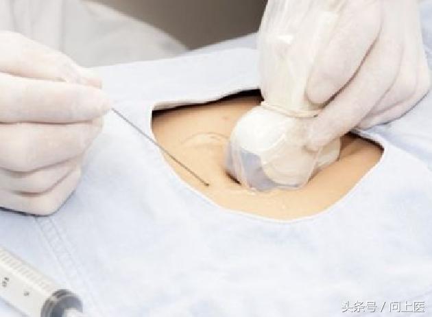 生男生女的谣言有哪些,到底生男生女要不要听谣言