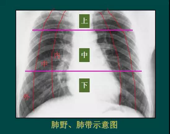读完该文，让你学会如何看胸片
