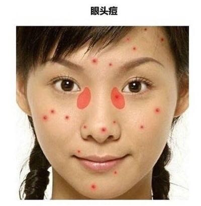 「看图识别长痘原因」还在苦恼长痘，如何祛痘，点开此文绝不后悔
