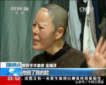 韩国人整形价格表,韩国割双眼皮要多少钱