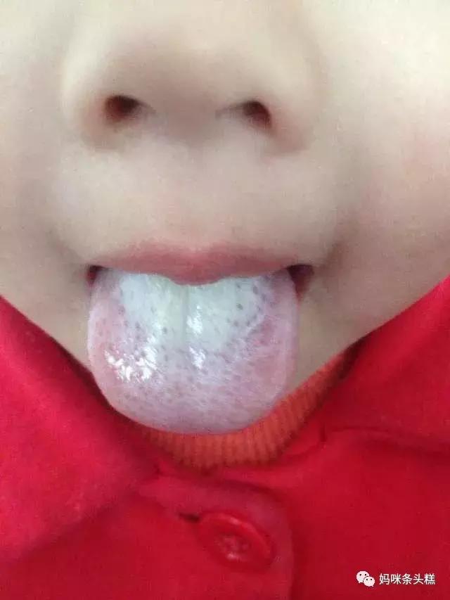 黄帝内经如何治疗眼袋,宝宝有黑眼圈没有食欲