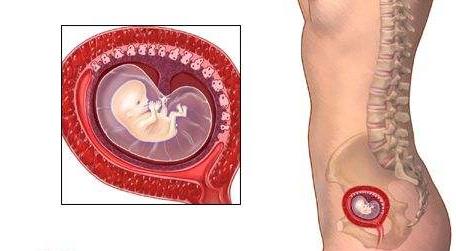 孕期一大杀手——先兆流产发生先兆流产该怎么办？