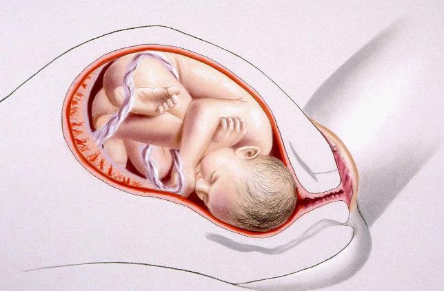 孕期一大杀手——先兆流产发生先兆流产该怎么办？