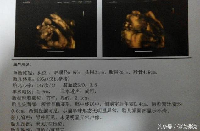 做四维彩超有什么关注事项,做四维彩超的关注事项是什么