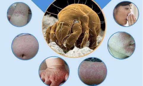 你在等着秋季的结束？秋意过后，过敏性鼻炎不再？它可以自愈吗？