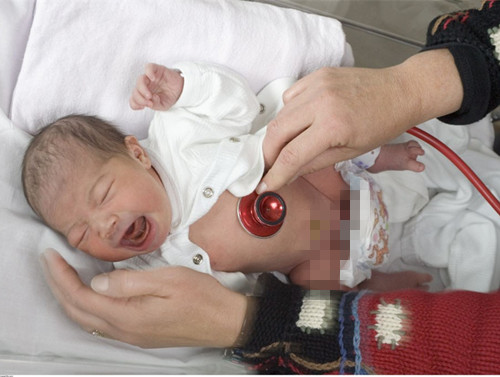 宝宝马牙该怎么处理,宝宝马牙处理方法