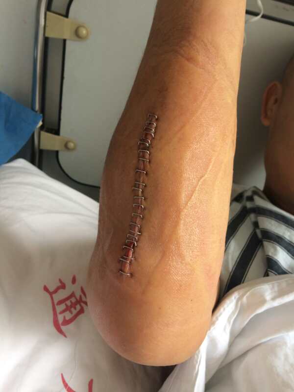 武僧一龙失败之战,武僧一虎掰手腕