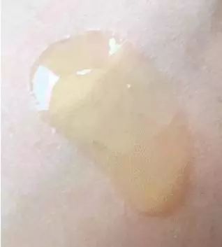 熬夜太多了皮肤变得有多差,一直熬夜皮肤很差怎么改善