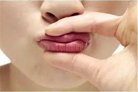 秋季婴儿嘴唇干裂出血,秋季嘴唇干裂怎么办小妙招