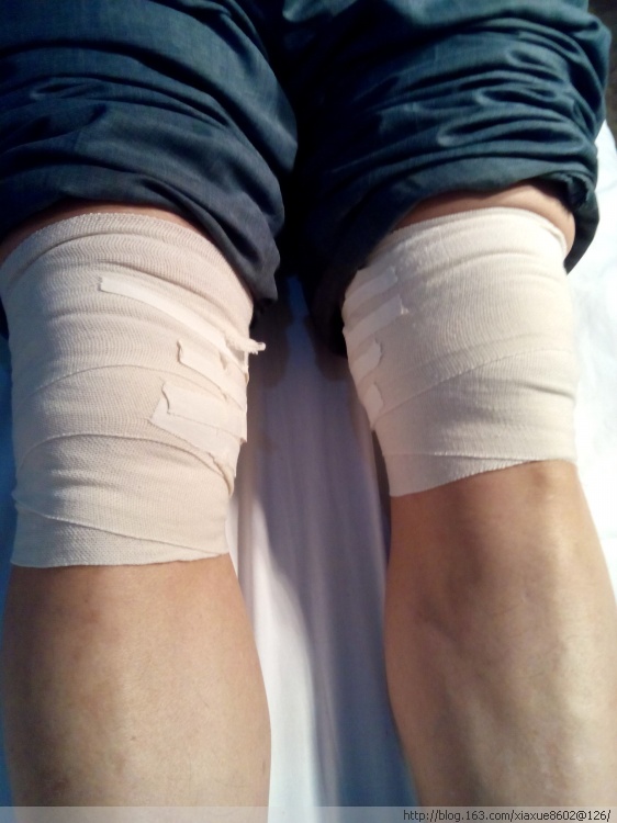 骨质疏松是每一个中老年人必须知道的，因为谁都会得